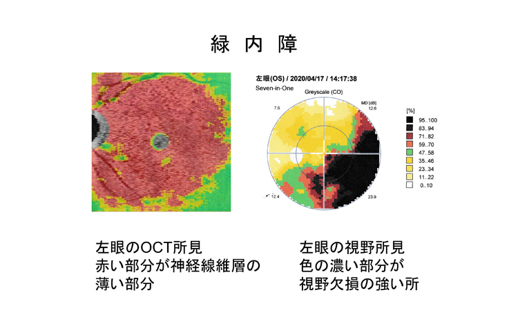 視力の発達